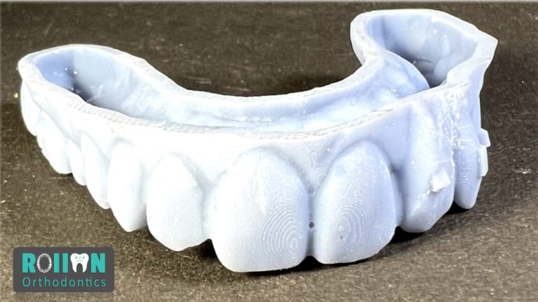 Rollon Orthodontics 4