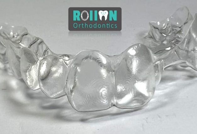 Rollon Orthodontics 1