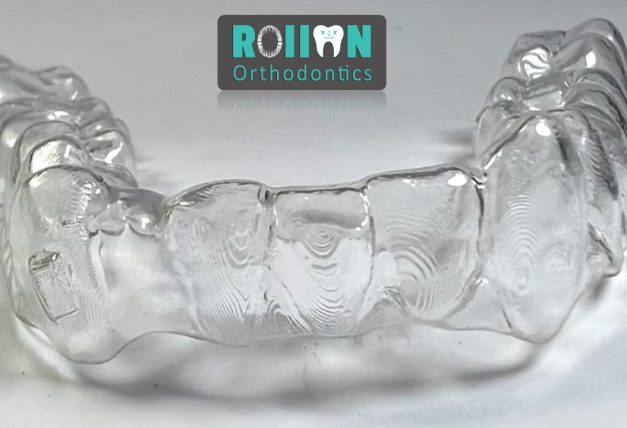 Rollon Orthodontics 2
